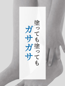 塗っても塗ってもガサガサ