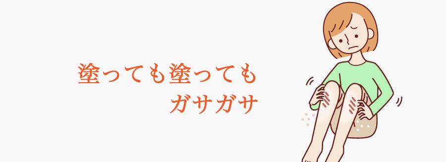 塗っても塗ってもガサガサ