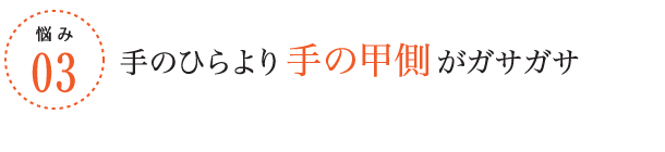 悩み3/手のひらより手の甲側がガサガサ
