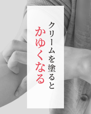 クリームを塗るとかゆくなる