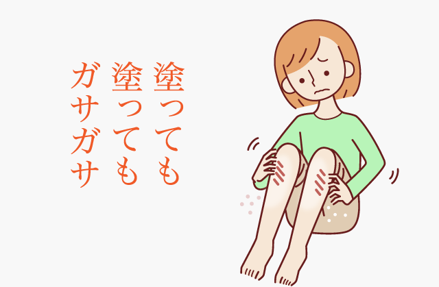 塗っても塗ってもガサガサ