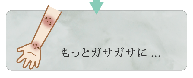 保湿クリームを塗るとかゆくなり、掻いてしまってさらにガサガサに