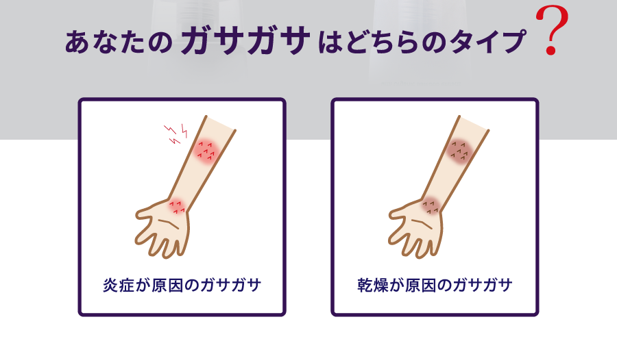 あなたのガサガサは(炎症が原因、乾燥が原因)どちらのタイプ?