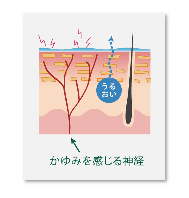 肌表面まで伸びたかゆみ神経