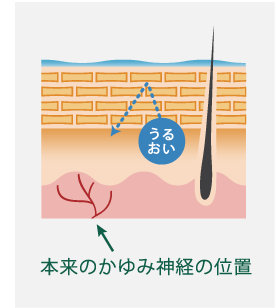 本来のかゆみ神経の位置