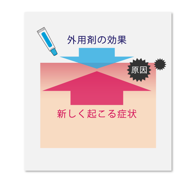 原因が続いていると薬を塗っても効果が感じられない場合もあります