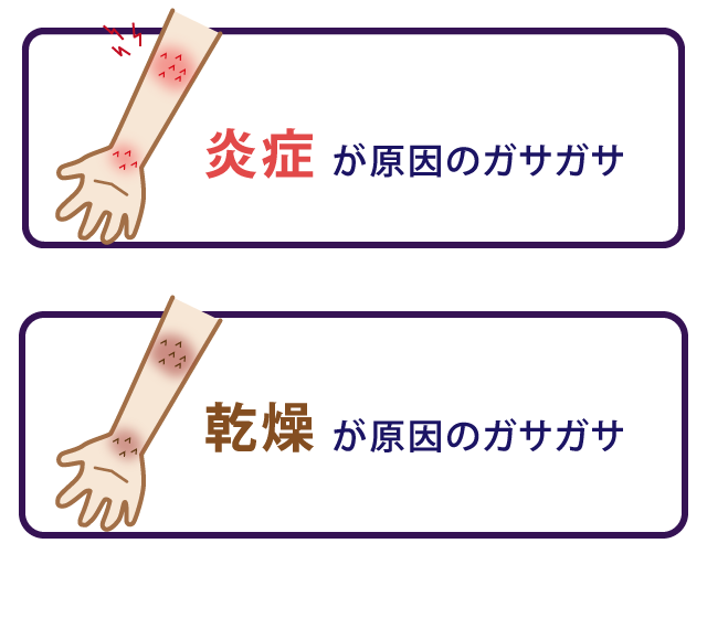 炎症が原因のガサガサ/乾燥が原因のガサガサ