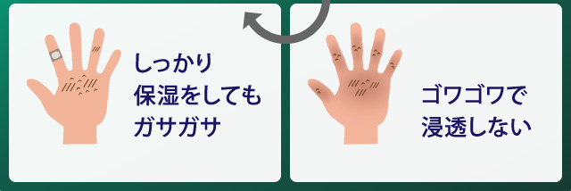 しっかり保湿をしてもガサガサ。ゴワゴワで浸透しない。